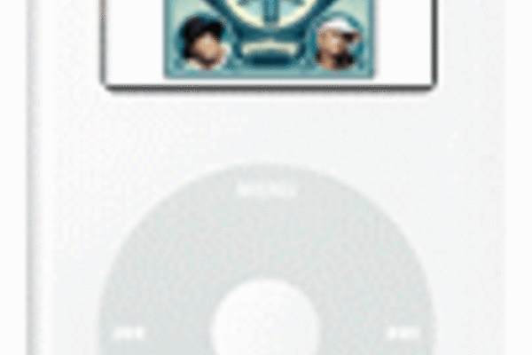 The iPod revolution will trigger more 'musical hallucinations'?